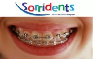 Sorridents instala primeira unidade em Ribeirão Pires